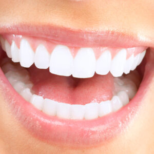 Teeth Whitening Seattle WA gpw main service pg img